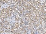 PSMD4 Antibody in Immunohistochemistry (Paraffin) (IHC (P))