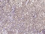 RUNX3 Antibody in Immunohistochemistry (Paraffin) (IHC (P))