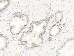 BRAF35 Antibody in Immunohistochemistry (Paraffin) (IHC (P))