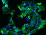 SARG Antibody in Immunocytochemistry (ICC/IF)