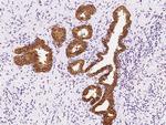 SARG Antibody in Immunohistochemistry (Paraffin) (IHC (P))