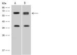 DDX56 Antibody in Western Blot (WB)