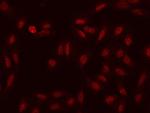 HSD17B6 Antibody in Immunocytochemistry (ICC/IF)