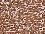 HSD17B6 Antibody in Immunohistochemistry (Paraffin) (IHC (P))