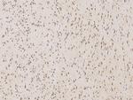 PSMD1 Antibody in Immunohistochemistry (Paraffin) (IHC (P))