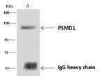 PSMD1 Antibody in Immunoprecipitation (IP)
