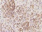 TAPT1 Antibody in Immunohistochemistry (Paraffin) (IHC (P))