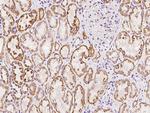 PCDH17 Antibody in Immunohistochemistry (Paraffin) (IHC (P))