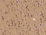 SCK Antibody in Immunohistochemistry (Paraffin) (IHC (P))