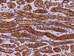 COA3 Antibody in Immunohistochemistry (Paraffin) (IHC (P))