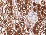 PFTK1 Antibody in Immunohistochemistry (Paraffin) (IHC (P))