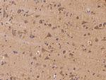 PFTK1 Antibody in Immunohistochemistry (Paraffin) (IHC (P))