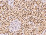 SBNO2 Antibody in Immunohistochemistry (Paraffin) (IHC (P))