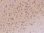 ZDHHC12 Antibody in Immunohistochemistry (Paraffin) (IHC (P))