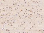 WBSCR17 Antibody in Immunohistochemistry (Paraffin) (IHC (P))