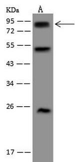 WBSCR17 Antibody in Western Blot (WB)