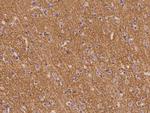 SV2B Antibody in Immunohistochemistry (Paraffin) (IHC (P))