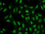 ATP8B4 Antibody in Immunocytochemistry (ICC/IF)