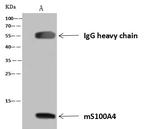 S100A4 Antibody in Immunoprecipitation (IP)