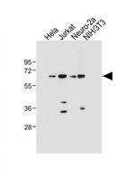 SMAD4 Antibody in Western Blot (WB)