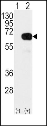 SMAD4 Antibody in Western Blot (WB)