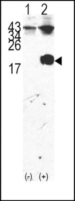 FKBP12 Antibody in Western Blot (WB)