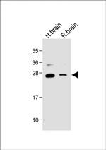 NTF3 Antibody in Western Blot (WB)