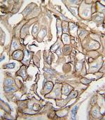 H-Ras Antibody in Immunohistochemistry (Paraffin) (IHC (P))