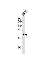 H-Ras Antibody in Western Blot (WB)