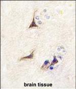 NGF Antibody in Immunohistochemistry (Paraffin) (IHC (P))