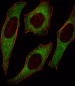 IRS2 Antibody in Immunocytochemistry (ICC/IF)