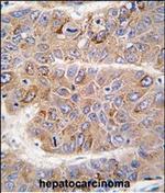 IRS2 Antibody in Immunohistochemistry (Paraffin) (IHC (P))