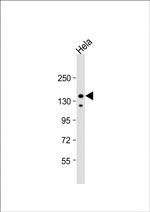 IRS2 Antibody in Western Blot (WB)