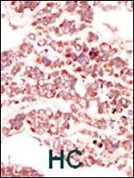 PTK7 Antibody in Immunohistochemistry (Paraffin) (IHC (P))