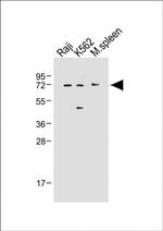 IRAK-M Antibody in Western Blot (WB)