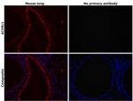 ACVRL1 Antibody in Immunohistochemistry (Paraffin) (IHC (P))