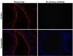 ACVRL1 Antibody in Immunohistochemistry (Paraffin) (IHC (P))