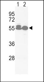 ACVRL1 Antibody in Western Blot (WB)