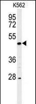 RIP3 Antibody in Western Blot (WB)