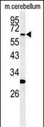 RIP3 Antibody in Western Blot (WB)