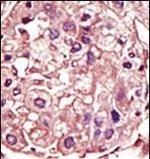 TGFBR1 Antibody in Immunohistochemistry (Paraffin) (IHC (P))