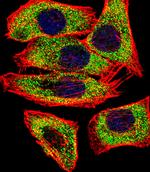 TGM2 Antibody in Immunocytochemistry (ICC/IF)