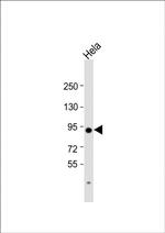 TGM2 Antibody in Western Blot (WB)