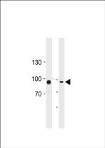 TGM2 Antibody in Western Blot (WB)