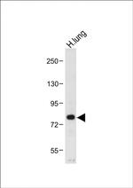 MUC20 Antibody in Western Blot (WB)