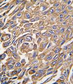 ALDH3A1 Antibody in Immunohistochemistry (Paraffin) (IHC (P))