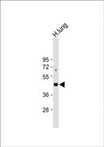 ALDH3A1 Antibody in Western Blot (WB)