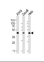 ALDH3A1 Antibody in Western Blot (WB)