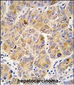 ALDH9A1 Antibody in Immunohistochemistry (Paraffin) (IHC (P))