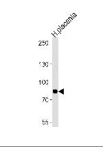 AMPD3 Antibody in Western Blot (WB)